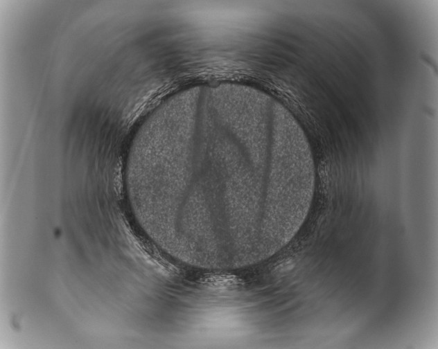 X0000099560642200806131235