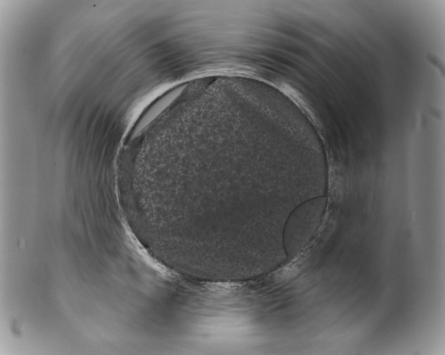 X0000099560854200806131232