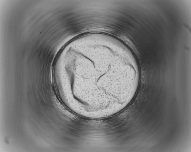 X0000099561036200806131230