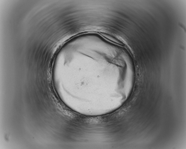 X0000099561125200806131228