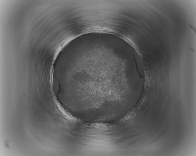 X0000099561128200806131228