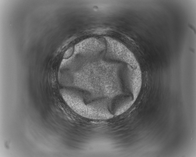 X0000099561158200806131228