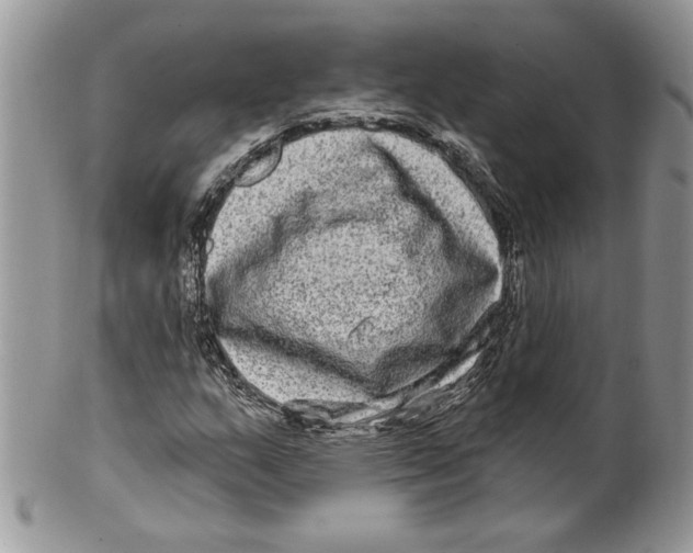 X0000099561159200806131228