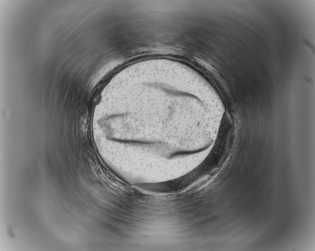 X0000099561163200806131228