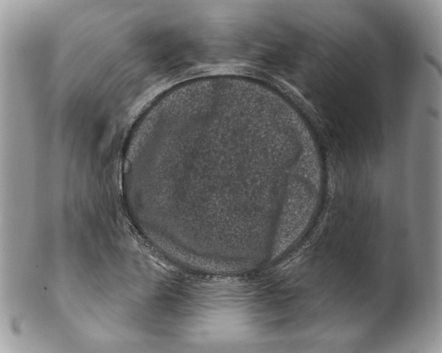 X0000099561174200806131227