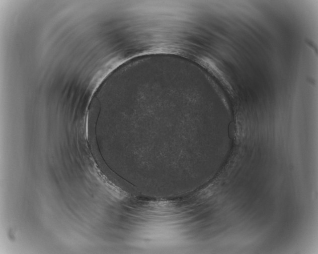 X0000099561276200806131226