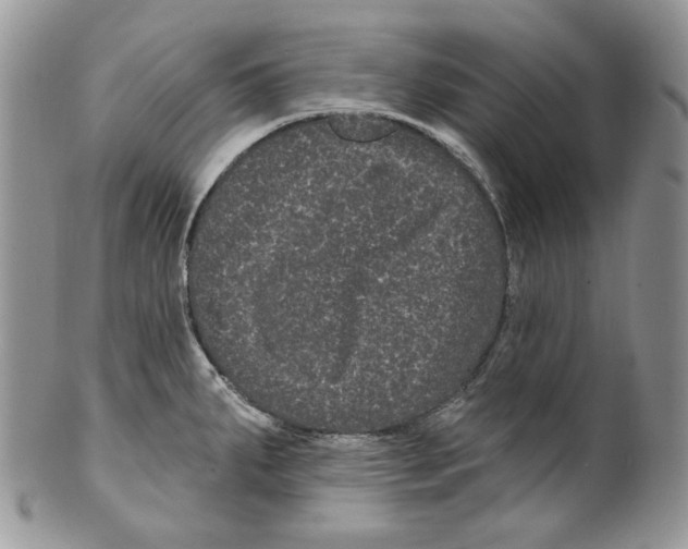 X0000099561287200806131226