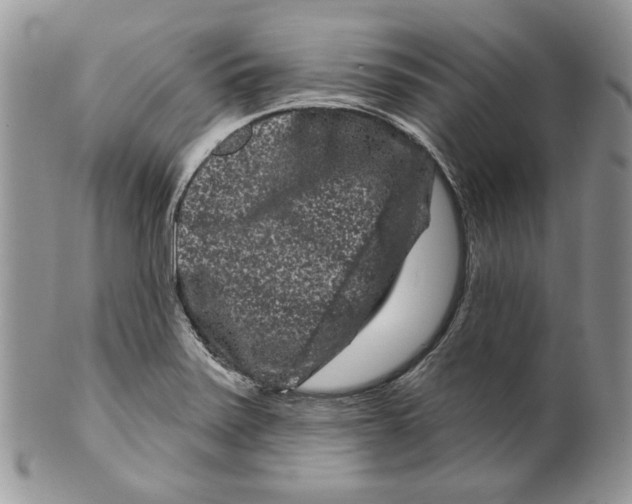 X0000099561371200806131225