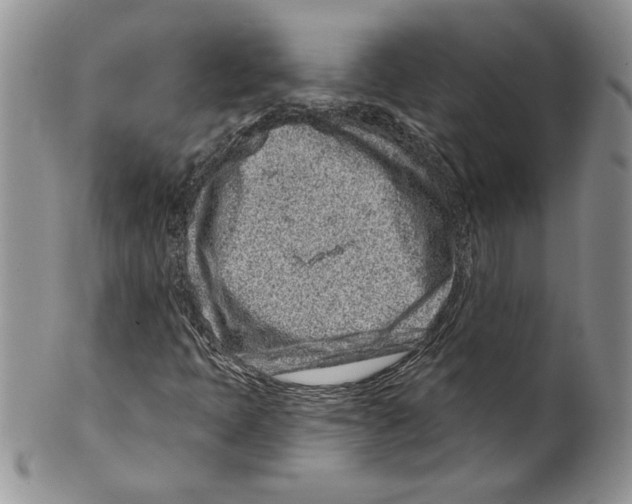 X0000099561397200806131224