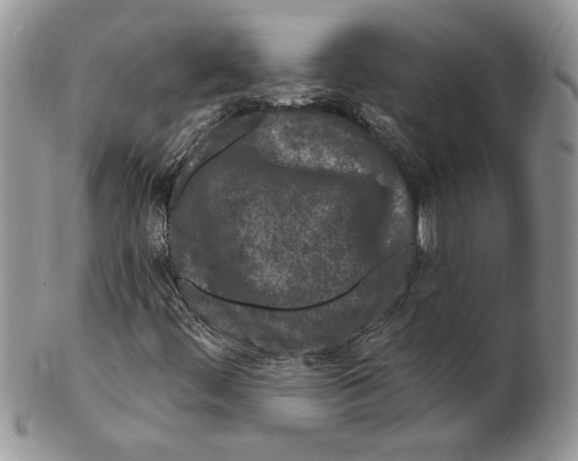 X0000099561444200806131224