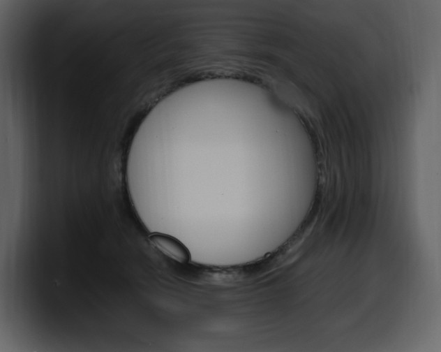 X0000099570466200805160729
