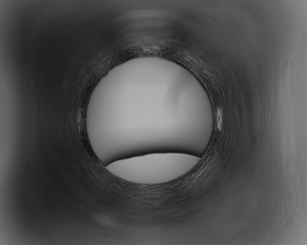 X0000099571395200805160716