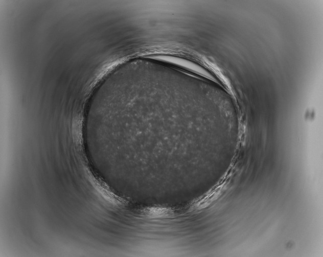 X0000099570154200805161525