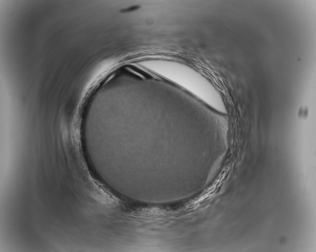 X0000099570197200805161525