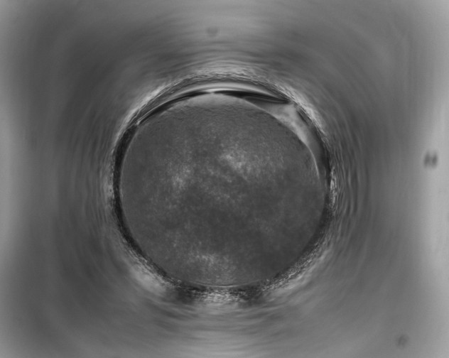 X0000099570399200805161521