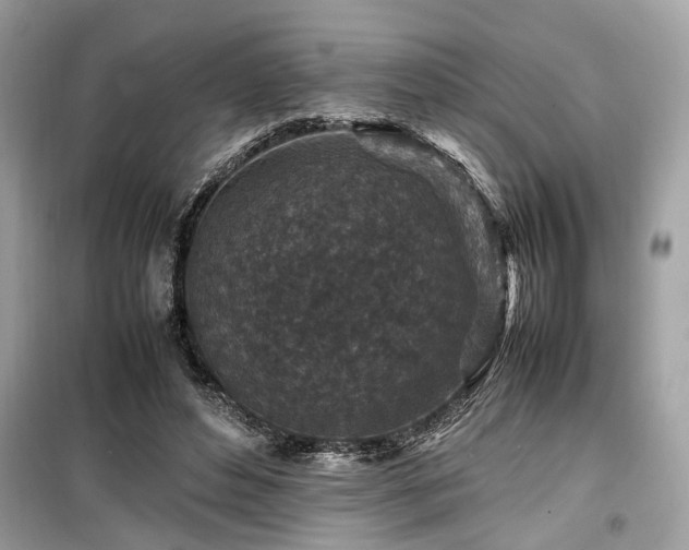 X0000099570496200805161520