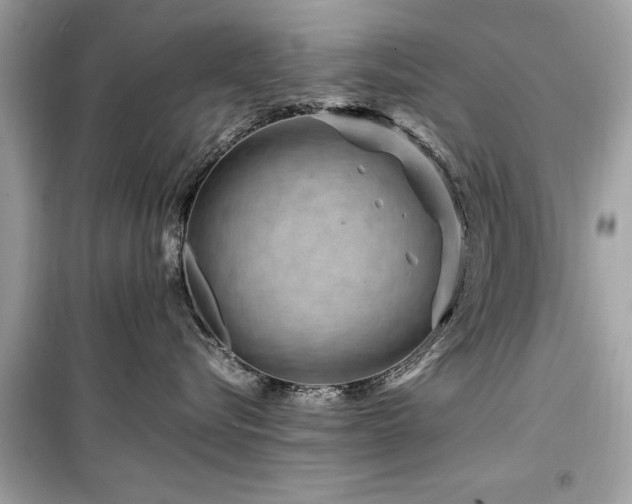 X0000099570576200805161519