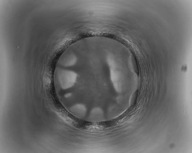 X0000099570691200805161517