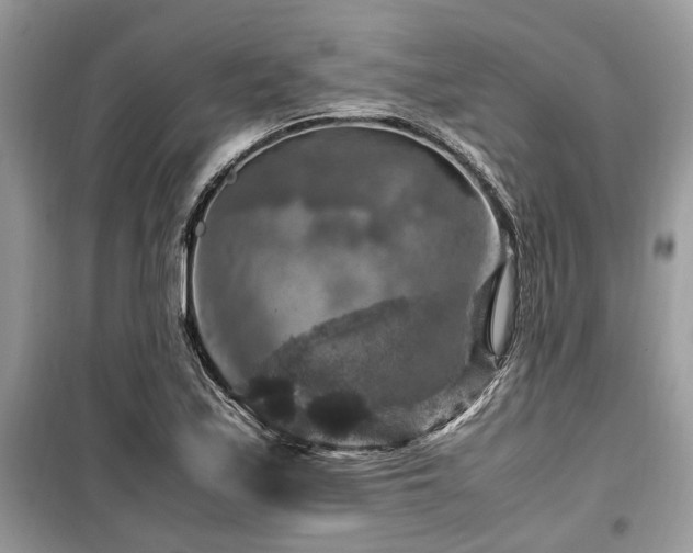 X0000099571171200805161510