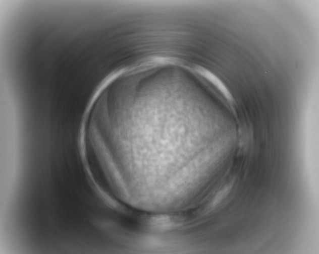 X0000099571098200805231527