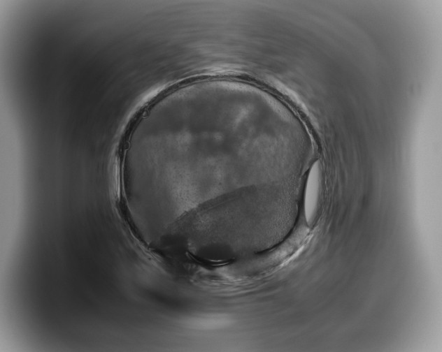 X0000099571171200805301535
