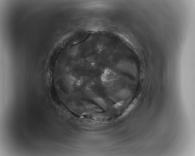 X0000099571398200805301531