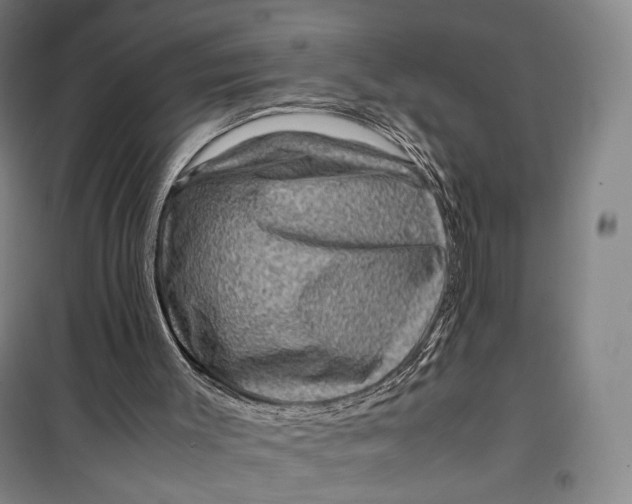 X0000099570003200806061614