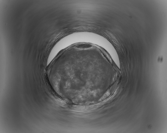 X0000099570045200806061613