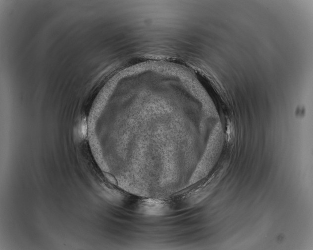 X0000099570095200806061613