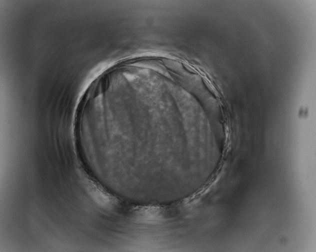 X0000099570104200806061613