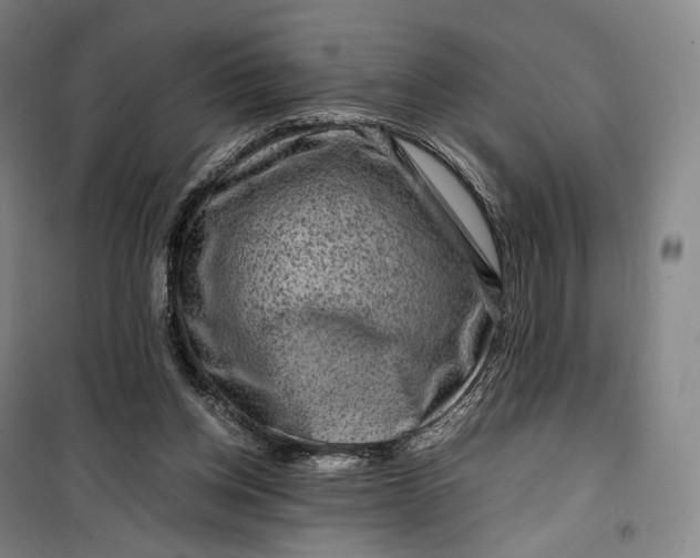 X0000099570158200806061611
