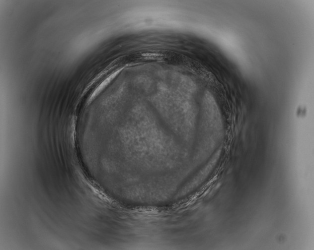 X0000099570194200806061611