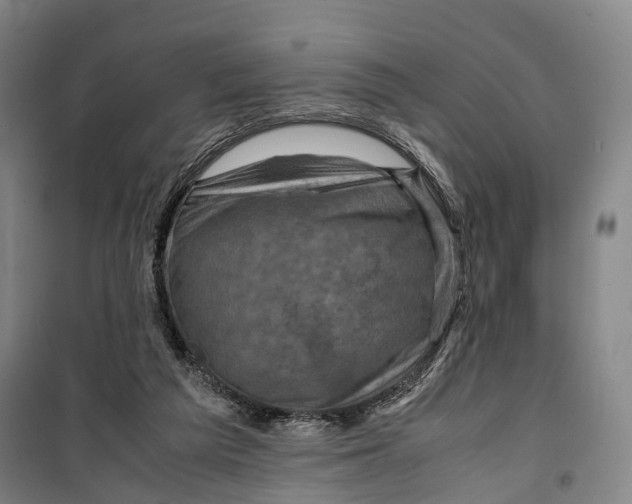 X0000099570209200806061611