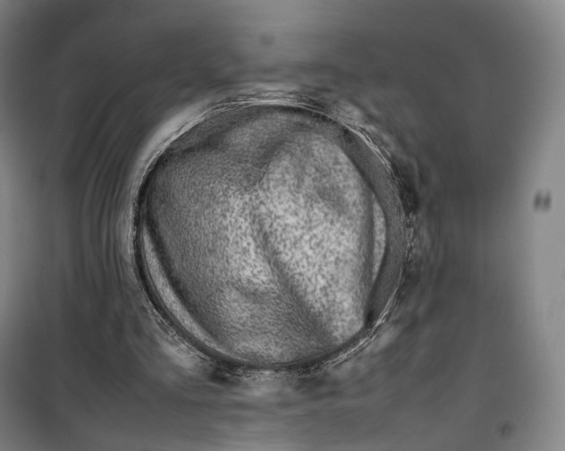 X0000099570293200806061609