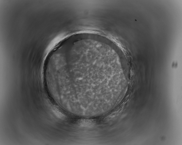 X0000099570296200806061609