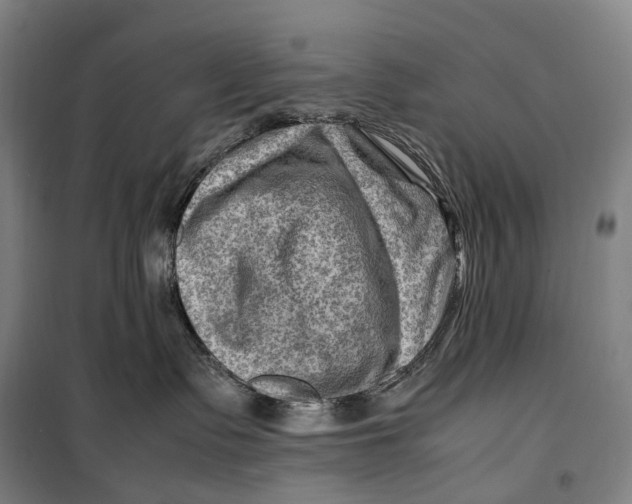 X0000099570335200806061609