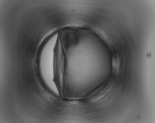 X0000099570396200806061608