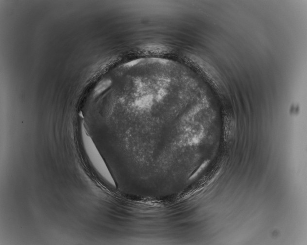 X0000099570451200806061607