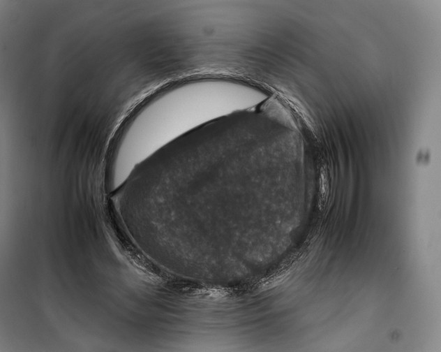 X0000099570492200806061606
