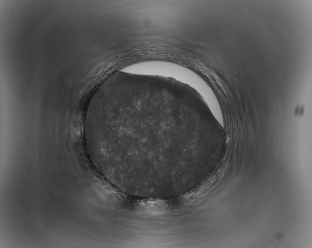 X0000099570517200806061606