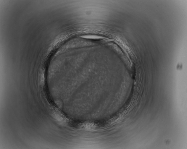 X0000099570685200806061603
