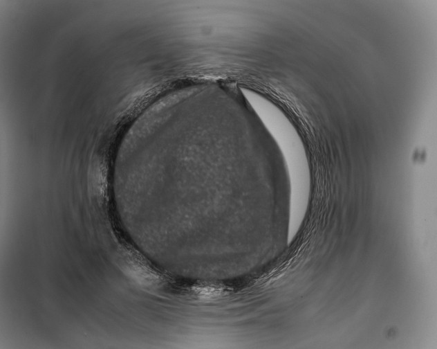 X0000099570693200806061603