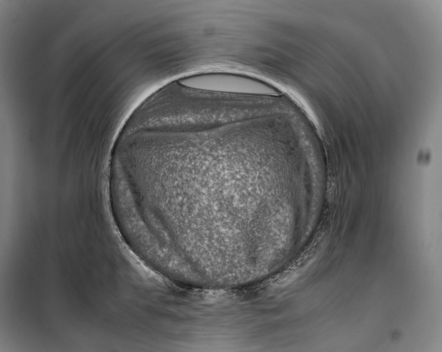 X0000099570903200806061600