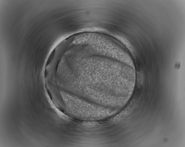 X0000099571046200806061558