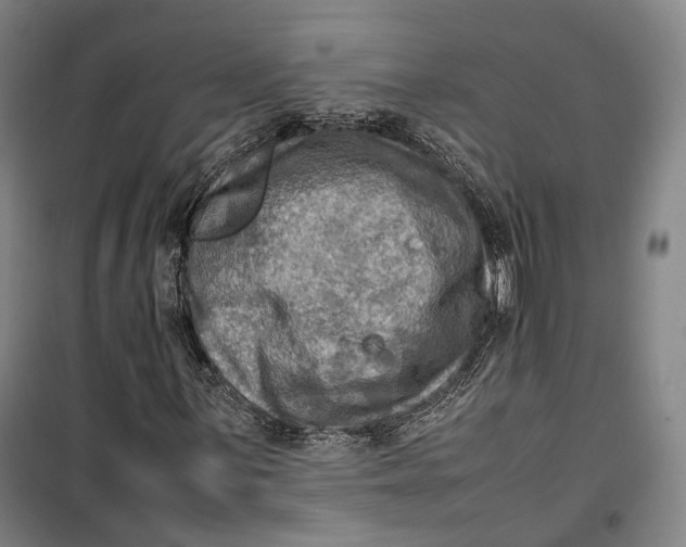 X0000099571059200806061557