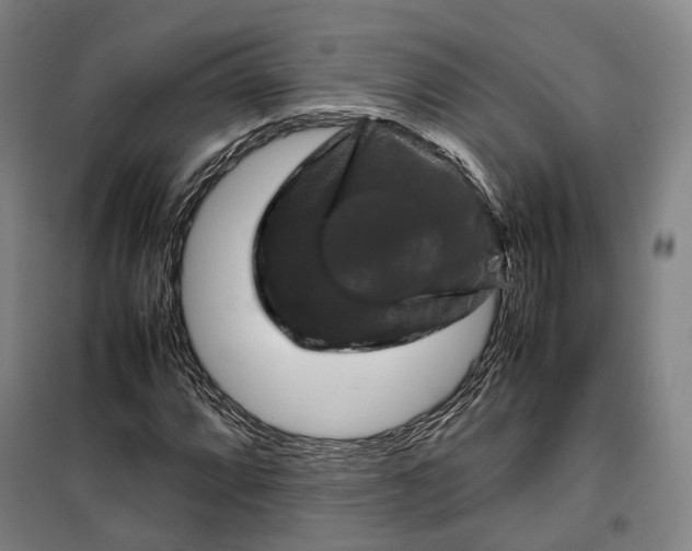 X0000099571064200806061557