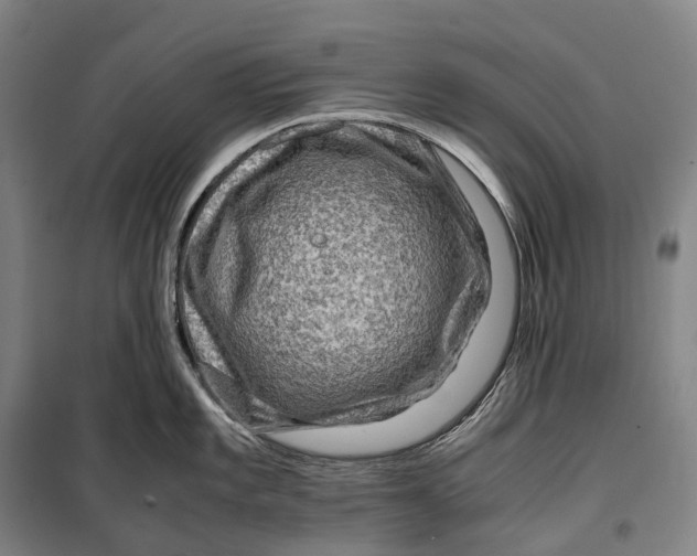 X0000099571101200806061557