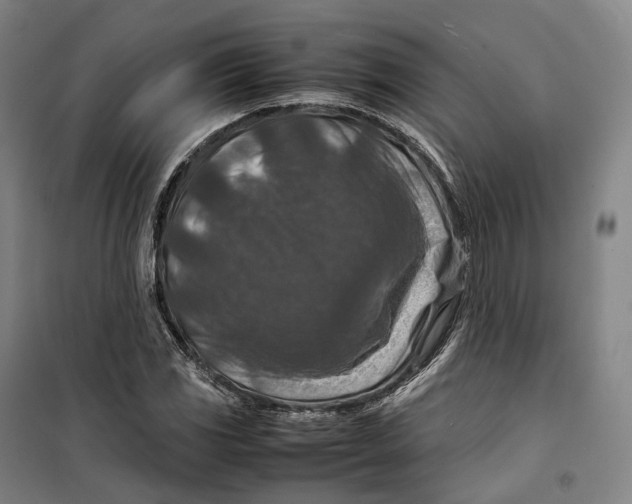 X0000099571117200806061556
