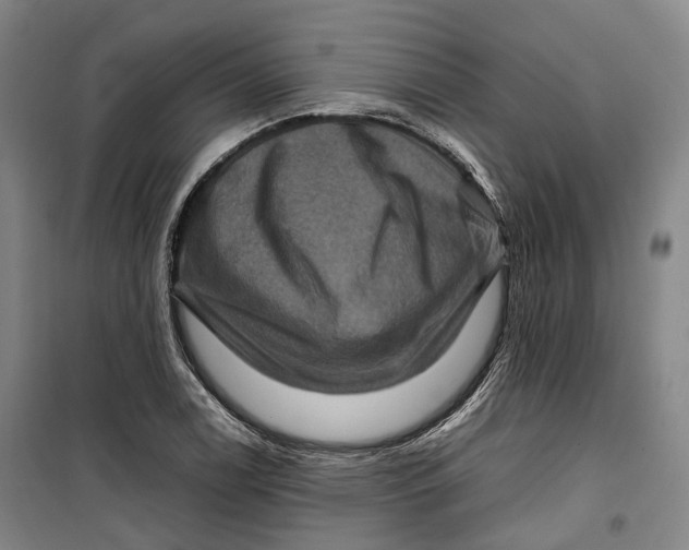 X0000099571122200806061556