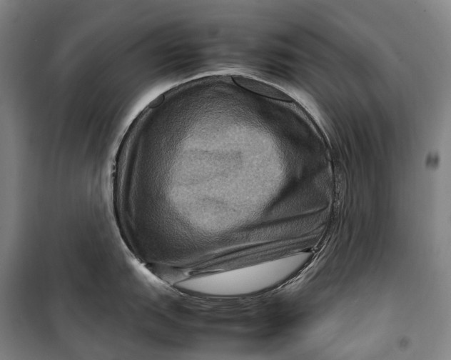 X0000099571151200806061557